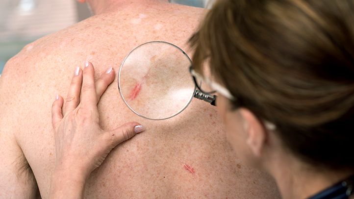 how-do-people-with-skin-cancer-live-their-lives?